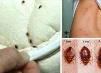 თქვენი საწოლი სავსეა ტკიპებით: ყველაფერი მათ შესახებ ! – რისი ეშინიათ და როგორ მოვიშოროთ ?!