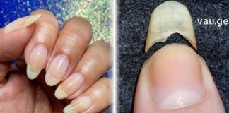 თუ გსურთ იყოთ ჯანმრთელები და არ დაავადდეთ, მაშინ დროულად მიაქციეთ ყურადღება თქვენი ფრჩხილების მდგომარეობას. მათი მტვრევა განგაშის სიგნალია !