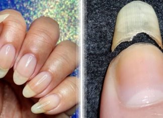 თუ გსურთ იყოთ ჯანმრთელები და არ დაავადდეთ, მაშინ დროულად მიაქციეთ ყურადღება თქვენი ფრჩხილების მდგომარეობას. მათი მტვრევა განგაშის სიგნალია !