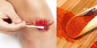 Როგორ შევაჩეროთ ჭრილობიდან სისხლდენა სულ რაღაც 10 წამში! – Ექიმებიც კი გვირჩევენ ამის გამოყენებას!