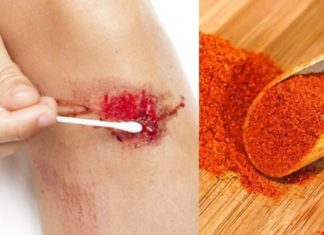 Როგორ შევაჩეროთ ჭრილობიდან სისხლდენა სულ რაღაც 10 წამში! – Ექიმებიც კი გვირჩევენ ამის გამოყენებას!