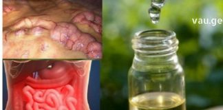 კლინიკური კვლევები ადასტურებს, რა ემართება თქვენს ორგანიზმს, თუ დროულად არ დაიწყებთ მის გაწმენდას!