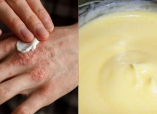 დახეთქილი კანის შველა არც ისე ძნელია : ამის შემდეგ სამუდამოდ განიკურნებით