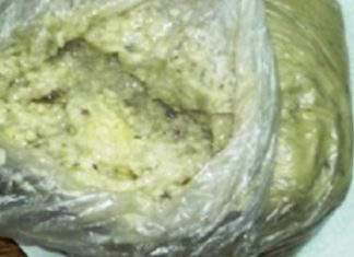 თუ ვენები დაგებერათ, ხალხური მედიცინა თქვენი მშვეველი გახდება ! შეუფასებელი მალამო, რომელიც დღესვე უნდა მოამზადოთ !