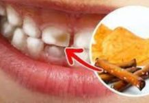 პროდუქტები რომლებიც ყოველდღიურად ანადგურებს კბილებს -გამოსავალს ამ სტატიაში იხილავთ !