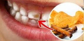 პროდუქტები რომლებიც ყოველდღიურად ანადგურებს კბილებს -გამოსავალს ამ სტატიაში იხილავთ !
