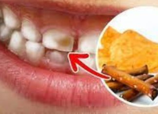 პროდუქტები რომლებიც ყოველდღიურად ანადგურებს კბილებს -გამოსავალს ამ სტატიაში იხილავთ !