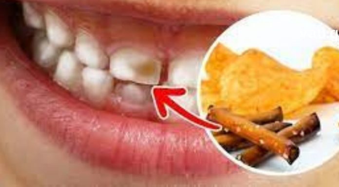 პროდუქტები რომლებიც ყოველდღიურად ანადგურებს კბილებს -გამოსავალს ამ სტატიაში იხილავთ !