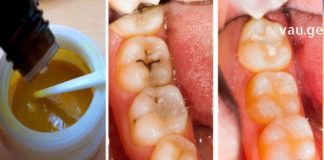 ეს ახალი რევოლუციური კბილის პასტა არა მხოლოდ ავსებს კბილებში არსებულ ყველა ნახვრეტსა და ბზარს, არამედ აღადგენს კბილის მინანქარს.