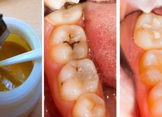 ეს ახალი რევოლუციური კბილის პასტა არა მხოლოდ ავსებს კბილებში არსებულ ყველა ნახვრეტსა და ბზარს, არამედ აღადგენს კბილის მინანქარს.