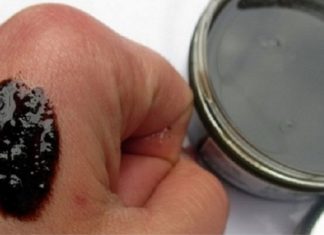 6 ფაქტი ფსორიაზის შესახებ: რა უნდა იცოდეთ ამ დაავადების შესახებ და როგორ უნდა იმკურნალოდ მარტივად სახლში?!