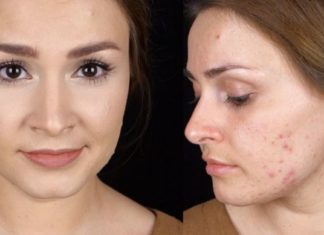 ეფექტური და სწრაფად მოქმედი რეცეპტები, რომელთა ინგრედიენტებს ძალიან იაფად შეიძენთ აფთიაქში თუ სახლში არ გაქვთ!