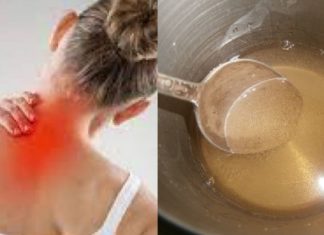 ეს მეთოდი შეგიმსუბუქებთ კისრის ტკივილს 7 დღეში – ამას წინათ ჩემს თავზე გამოვცადე და დავრწმუნდი, რომ მართლაც საოცარია!