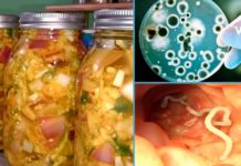 მძლავრი ანტიპარაზიტული მცენარეები – მათი სარგებლის გაგება ჩემთვის ნამდვილი აღმოჩენაა!