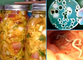 მძლავრი ანტიპარაზიტული მცენარეები – მათი სარგებლის გაგება ჩემთვის ნამდვილი აღმოჩენაა!