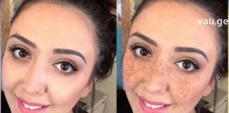 ამ “ფაფებით’ დაიბანეთ სახის კანი და შესაძლოა შემდგომ საკუთარ თვალებსაც კი აღარ დაუჯეროთ!! ჭორფლების გაქრობაზე ოცნება ასეთი ხელმისაწვდომი ჯერ არ ყოფილა !