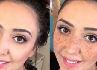 ამ “ფაფებით’ დაიბანეთ სახის კანი და შესაძლოა შემდგომ საკუთარ თვალებსაც კი აღარ დაუჯეროთ!! ჭორფლების გაქრობაზე ოცნება ასეთი ხელმისაწვდომი ჯერ არ ყოფილა !