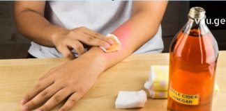 გვირილის კომპრესი, სველი, ცხელი საფენები 10 – ჯერ უფრო ძლიერია ვიდრე ნებისმიერი სააფთიაქო ანთების საწინააღმდეგო საშუალება !
