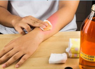 გვირილის კომპრესი, სველი, ცხელი საფენები 10 – ჯერ უფრო ძლიერია ვიდრე ნებისმიერი სააფთიაქო ანთების საწინააღმდეგო საშუალება !