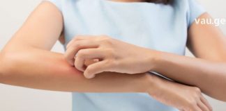 რთული პრობლემის გადაჭრა მარტივად – აი რა უნდა იცოდეთ თუ აუტანელი ქავილი გაქვთ !