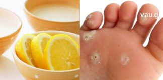 სულ რაღაც 10 წუთი და მაზოლებისგან გათავისუფლდებით ყოველგვარი ძალისხმევის გარეშე – მუდმივი პრობლემის გადაჭრა სწრაფად და ეფექტურად !