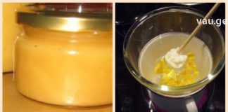 ჯადოსნური მალამო, რომელიც ვარიკოზული ვენების მშველელია ყველაზე რთულ ეტაპზეც კი!