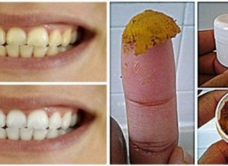 საოცარი მეთოდები, რომელთაც ცნობილი სტომატოლოგი გვირჩევს თეთრი და ჯანსაღი კბილებისთვის !