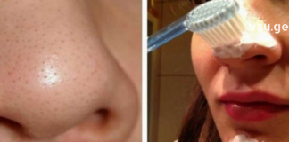 ფერიმჭამელების მოსაშორებელი უნივერსალური ნიღბის დამზადება ძალიან ადვილია : იხილეთ რეცეპტი