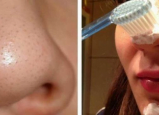 ფერიმჭამელების მოსაშორებელი უნივერსალური ნიღბის დამზადება ძალიან ადვილია : იხილეთ რეცეპტი