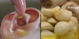 ასობით წლის წინ ეს რეცეპტები ყურის ინფექციებისა და სმენა დაქვეითების სამკურნალოდ წარმატებით გამოიყენებოდა.