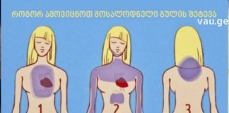 ინფარქტის თავიდან აცილება შესაძლებელია თუ რამდენიმე თვით ადრე გამოვლენილ სიმპტომებს დაუკვირდებით: საინტერესოა როგორ ამოვიცნოთ?!