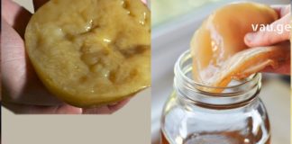 მოიცილეთ გლანდების ანთება სულ რაღაც 24 საათში : დროში გამოცდილი ყველაზე ეფექტური მეთოდი!