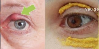 ეს საინტერესოა: Როგორ ეხმარება მარილიანი ხსნარი თვალის ინფექციას?!