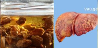 5 ნატურალური სასმელი ღვიძლის გასაწმენდად და წონის დასაკლებად!