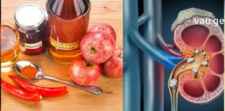 თუ თირკმელებში კენჭები დაგიგროვდათ,უმჯობესია დასახმარებლად ბუნებას მიმართოთ !