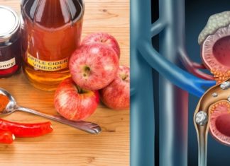 თუ თირკმელებში კენჭები დაგიგროვდათ,უმჯობესია დასახმარებლად ბუნებას მიმართოთ !