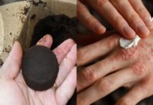 Რამდენად ადვილია სოკოს მოშორება ძვირადღირებული მედიკამენტების გარეშე? -ეს უკვე შესაძლებელია ამ ინგრედიენტის გამოყენებით!