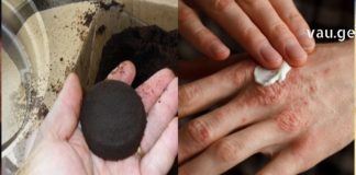 Რამდენად ადვილია სოკოს მოშორება ძვირადღირებული მედიკამენტების გარეშე? -ეს უკვე შესაძლებელია ამ ინგრედიენტის გამოყენებით!