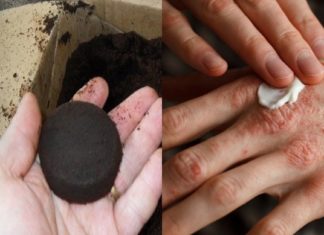 Რამდენად ადვილია სოკოს მოშორება ძვირადღირებული მედიკამენტების გარეშე? -ეს უკვე შესაძლებელია ამ ინგრედიენტის გამოყენებით!