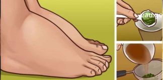 სასწრაფოდ!! ვისაც ფეხების შეშუპება აწუხებს ვურჩევთ გაეცნონ ამ ფასდაუდებელ რეცეპტებს, რომელთა დახმარებითაც პრობლემა ერთხელ და სამუდამოდ მოგვარდება..