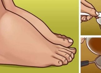 სასწრაფოდ!! ვისაც ფეხების შეშუპება აწუხებს ვურჩევთ გაეცნონ ამ ფასდაუდებელ რეცეპტებს, რომელთა დახმარებითაც პრობლემა ერთხელ და სამუდამოდ მოგვარდება..