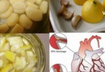 დალიეთ ეს ნარევი მხოლოდ 3 სუფრის კოვზი და არტერიული წნევის ყველა პრობლემა გაქრება !