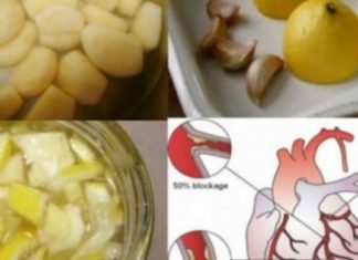 დალიეთ ეს ნარევი მხოლოდ 3 სუფრის კოვზი და არტერიული წნევის ყველა პრობლემა გაქრება !