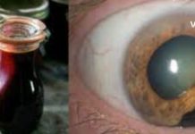 თუ ამ უნიკალურ რეცეპტს მოამზადებთ, არასოდეს მიხვალთ ექიმთან: წამალი, რომელიც დაგიბრუნებთ მხედველობას, გაასუფთავებს მსხვილ ნაწლავს და მოაშორებს ცხიმებს ღვიძლიდან!