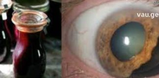 თუ ამ უნიკალურ რეცეპტს მოამზადებთ, არასოდეს მიხვალთ ექიმთან: წამალი, რომელიც დაგიბრუნებთ მხედველობას, გაასუფთავებს მსხვილ ნაწლავს და მოაშორებს ცხიმებს ღვიძლიდან!