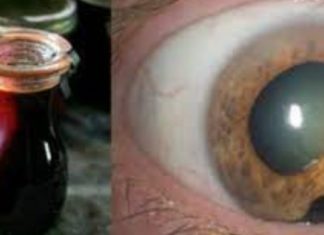 თუ ამ უნიკალურ რეცეპტს მოამზადებთ, არასოდეს მიხვალთ ექიმთან: წამალი, რომელიც დაგიბრუნებთ მხედველობას, გაასუფთავებს მსხვილ ნაწლავს და მოაშორებს ცხიმებს ღვიძლიდან!