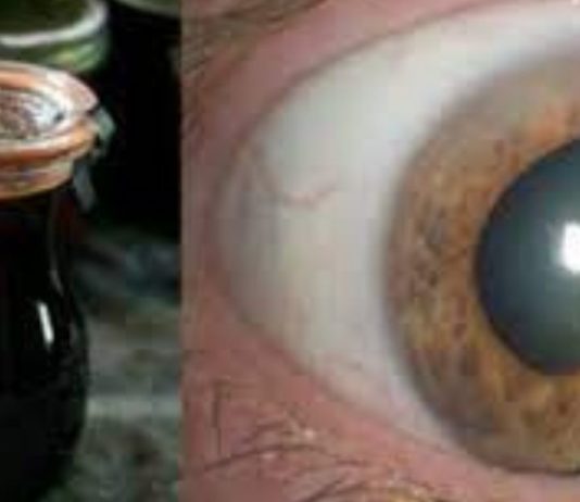 თუ ამ უნიკალურ რეცეპტს მოამზადებთ, არასოდეს მიხვალთ ექიმთან: წამალი, რომელიც დაგიბრუნებთ მხედველობას, გაასუფთავებს მსხვილ ნაწლავს და მოაშორებს ცხიმებს ღვიძლიდან!