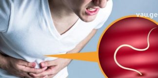 Როგორ გავასუფთავოთ ორგანიზმი პარაზიტებისგან? საუკეთესო ანტიპარაზიტული საშუალება, რომელიც ხალხური მედიცინის კრებულში აღმოვაჩინე!