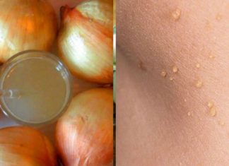 თუ ამას გააკეთებთ, 1 სუფრის კოვზიც კი საკმარისი იქნება, რომ ამოფხვრას პაპილომა უმოკლეს დროში!!