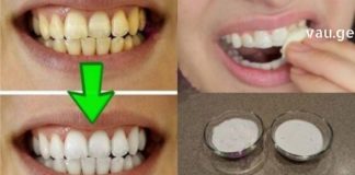 ასაკის მოუხედავად ყველას გვინდა თეთრი და ნათელი ღიმილი – ამ სტატიაში გაგიზიარებთ ჯანსაღ ინგრედიენტებს, რომლებსაც შეუძლია გაათეთროს კბილები